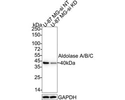Invitrogen Aldolase A/B/C Recombinant Rabbit Monoclonal Antibody (PSH01-81)