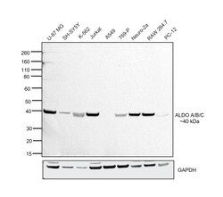 Invitrogen Aldolase A/B/C Recombinant Rabbit Monoclonal Antibody (PSH01-81)