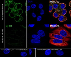 Invitrogen&trade;&nbsp;B7-H4 Recombinant Rabbit Monoclonal Antibody (PSH03-65)