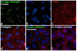 Invitrogen&trade;&nbsp;Phospho-SMAD2/SMAD3 (Ser465, Ser467, Ser423, Ser425) Recombinant Rabbit Monoclonal Antibody (ST0493)