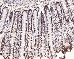 Invitrogen Phospho-SMAD2/SMAD3 (Ser465, Ser467, Ser423, Ser425) Recombinant Rabbit Monoclonal Antibody (ST0493) 100 &mu;L | Buy Online | Invitrogen&trade; | Fisher Scientific