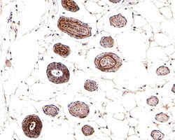 Invitrogen Phospho-SMAD2/SMAD3 (Ser465, Ser467, Ser423, Ser425) Recombinant Rabbit Monoclonal Antibody (ST0493) 100 &mu;L | Buy Online | Invitrogen&trade; | Fisher Scientific