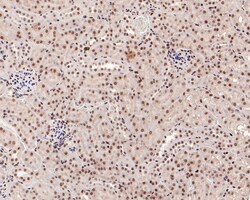Invitrogen Phospho-SMAD2/SMAD3 (Ser465, Ser467, Ser423, Ser425) Recombinant Rabbit Monoclonal Antibody (ST0493) 100 &mu;L | Buy Online | Invitrogen&trade; | Fisher Scientific
