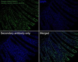 Invitrogen Phospho-SMAD2/SMAD3 (Ser465, Ser467, Ser423, Ser425) Recombinant Rabbit Monoclonal Antibody (ST0493) 100 &mu;L | Buy Online | Invitrogen&trade; | Fisher Scientific