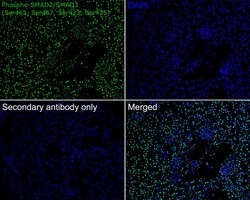 Invitrogen Phospho-SMAD2/SMAD3 (Ser465, Ser467, Ser423, Ser425) Recombinant Rabbit Monoclonal Antibody (ST0493) 100 &mu;L | Buy Online | Invitrogen&trade; | Fisher Scientific