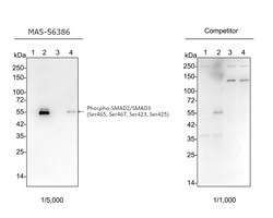 Invitrogen Phospho-SMAD2/SMAD3 (Ser465, Ser467, Ser423, Ser425) Recombinant Rabbit Monoclonal Antibody (ST0493) 100 &mu;L | Buy Online | Invitrogen&trade; | Fisher Scientific