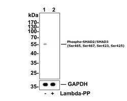 Invitrogen Phospho-SMAD2/SMAD3 (Ser465, Ser467, Ser423, Ser425) Recombinant Rabbit Monoclonal Antibody (ST0493) 100 &mu;L | Buy Online | Invitrogen&trade; | Fisher Scientific