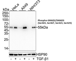 Invitrogen Phospho-SMAD2/SMAD3 (Ser465, Ser467, Ser423, Ser425) Recombinant Rabbit Monoclonal Antibody (ST0493) 100 &mu;L | Buy Online | Invitrogen&trade; | Fisher Scientific