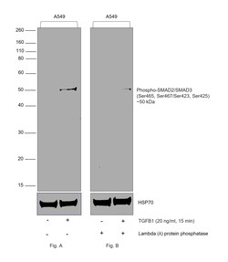 Invitrogen Phospho-SMAD2/SMAD3 (Ser465, Ser467, Ser423, Ser425) Recombinant Rabbit Monoclonal Antibody (ST0493) 100 &mu;L | Buy Online | Invitrogen&trade; | Fisher Scientific
