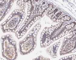 Invitrogen PRMT4 Recombinant Rabbit Monoclonal Antibody (PSH05-08) 100