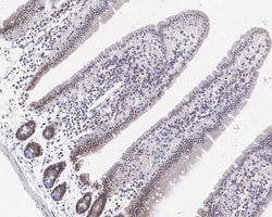 Invitrogen PRMT4 Recombinant Rabbit Monoclonal Antibody (PSH05-08) 100