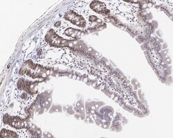 Invitrogen PRMT4 Recombinant Rabbit Monoclonal Antibody (PSH05-08) 100