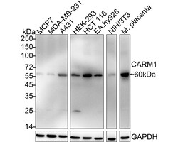 Invitrogen PRMT4 Recombinant Rabbit Monoclonal Antibody (PSH05-08) 100