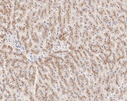 Invitrogen C1S Recombinant Rabbit Monoclonal Antibody (JE61-95) 100 &mu;L;