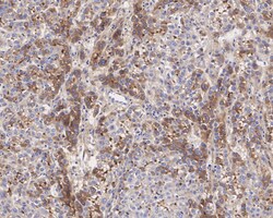 Invitrogen C1S Recombinant Rabbit Monoclonal Antibody (JE61-95) 100 &mu;L;