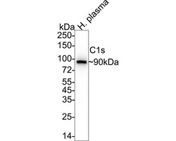 Invitrogen C1S Recombinant Rabbit Monoclonal Antibody (JE61-95) 100 &mu;L;