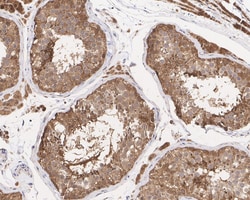 Invitrogen Acid Phosphatase 1 Recombinant Rabbit Monoclonal Antibody (PSH04-57)