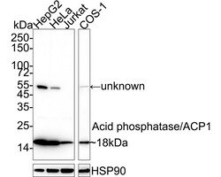 Invitrogen Acid Phosphatase 1 Recombinant Rabbit Monoclonal Antibody (PSH04-57)
