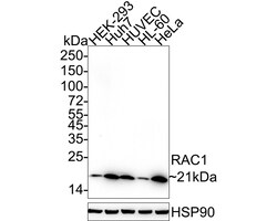 Invitrogen RAC1 Recombinant Rabbit Monoclonal Antibody (PSH05-09) 100 &mu;L;