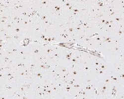 Invitrogen CUGBP1 Recombinant Mouse Monoclonal Antibody (7A1-R) 100 &mu;L;