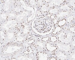 Invitrogen CUGBP1 Recombinant Mouse Monoclonal Antibody (7A1-R) 100 &mu;L;