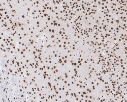 Invitrogen CUGBP1 Recombinant Mouse Monoclonal Antibody (7A1-R) 100 &mu;L;