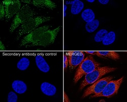 Invitrogen TIMP3 Recombinant Rabbit Monoclonal Antibody (PSH04-41) 100