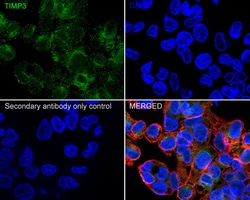 Invitrogen TIMP3 Recombinant Rabbit Monoclonal Antibody (PSH04-41) 100