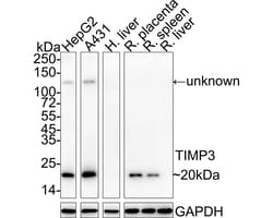 Invitrogen TIMP3 Recombinant Rabbit Monoclonal Antibody (PSH04-41) 100