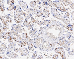 Invitrogen Adiponectin Recombinant Rabbit Monoclonal Antibody (PSH05-48)