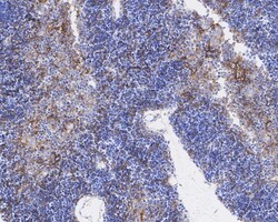 Invitrogen PD-L1 Recombinant Rabbit Monoclonal Antibody (PSH04-80) 100