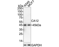 Invitrogen Carbonic Anhydrase XII Recombinant Rabbit Monoclonal Antibody