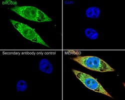 Invitrogen BRCC3 Recombinant Rabbit Monoclonal Antibody (PSH05-10) 100