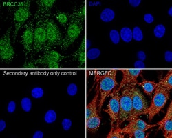 Invitrogen BRCC3 Recombinant Rabbit Monoclonal Antibody (PSH05-10) 100