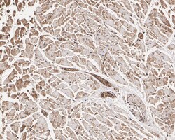 Invitrogen BRCC3 Recombinant Rabbit Monoclonal Antibody (PSH05-10) 100