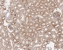 Invitrogen BRCC3 Recombinant Rabbit Monoclonal Antibody (PSH05-10) 100