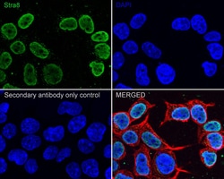 Invitrogen STRA8 Recombinant Rabbit Monoclonal Antibody (PSH04-55) 100