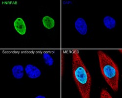 Invitrogen hnRNP AB Recombinant Rabbit Monoclonal Antibody (PSH05-37) 100