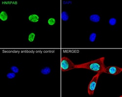 Invitrogen hnRNP AB Recombinant Rabbit Monoclonal Antibody (PSH05-37) 100
