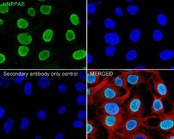 Invitrogen hnRNP AB Recombinant Rabbit Monoclonal Antibody (PSH05-37) 100