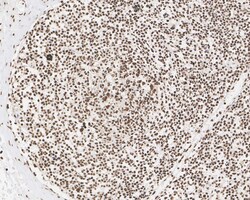 Invitrogen hnRNP AB Recombinant Rabbit Monoclonal Antibody (PSH05-37) 100