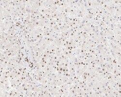 Invitrogen hnRNP AB Recombinant Rabbit Monoclonal Antibody (PSH05-37) 100