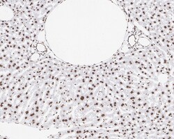 Invitrogen hnRNP AB Recombinant Rabbit Monoclonal Antibody (PSH05-37) 100