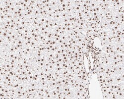 Invitrogen hnRNP AB Recombinant Rabbit Monoclonal Antibody (PSH05-37) 100