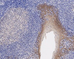 Invitrogen CSNK1A1/CSNK1A1L Recombinant Rabbit Monoclonal Antibody (PSH04-58)