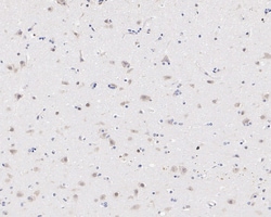 Invitrogen CSNK1A1/CSNK1A1L Recombinant Rabbit Monoclonal Antibody (PSH04-58)