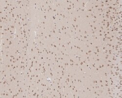 Invitrogen CSNK1A1/CSNK1A1L Recombinant Rabbit Monoclonal Antibody (PSH04-58)