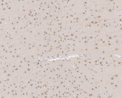 Invitrogen CSNK1A1/CSNK1A1L Recombinant Rabbit Monoclonal Antibody (PSH04-58)