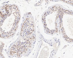 Invitrogen SAV1 Recombinant Rabbit Monoclonal Antibody (PSH04-45) 100 &mu;L;