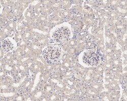 Invitrogen SAV1 Recombinant Rabbit Monoclonal Antibody (PSH04-45) 100 &mu;L;